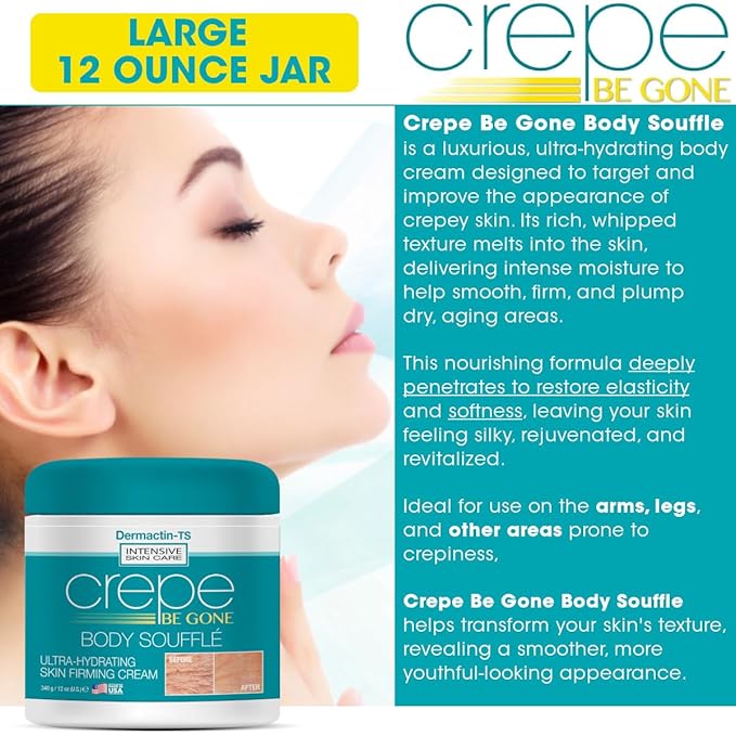 Crepe Be Gone Body Souffle Classic - Large 12 ounce - Ultra Hydrating Crepe Skin Firming Cream for Neck,Chest, Arms & Legs