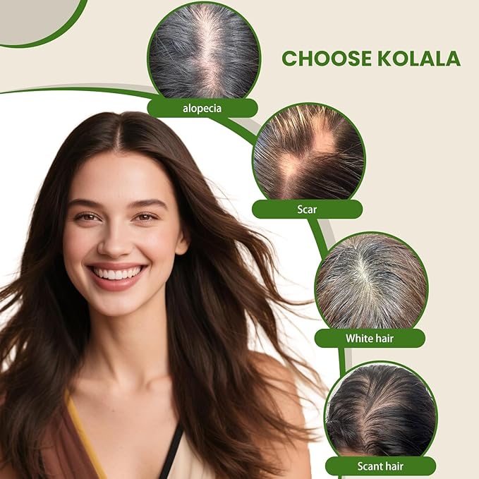 HAIR Real Human Hair Toppers for Women 150 Density 6x7inch Hand-Tied 65 grams 14 inch Hair medium dark brown for Women with Thinning Crown (#4 14inch)