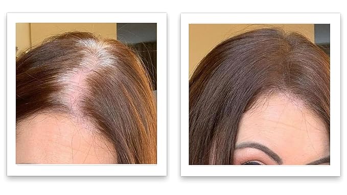 Caboki 10X Hair Powder for Thinning Hair, TALC-Free, Healthful Formula, Instant Fuller Hair, Flawless Roots, Rain and Sweat Resistant, Easy to Use, Natural Blonde, Men and Women