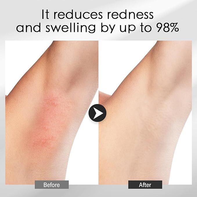 Cooling Gel for Hair Removal Device 300g Soothing Cooling Conductive Gel on Face Body Legs Arms Underarms for Woman and Men with Aloe Vera Centella Asiatica