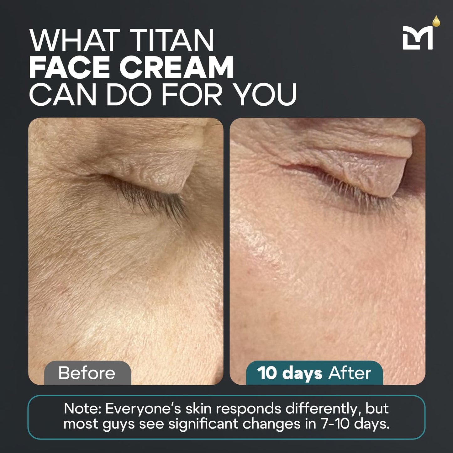 Titan Peptide Anti-Aging Mens Face Cream – Mens Face Moisturizer – For Men, Face Lotion – Men, Skin Care – Tighten, Firm, Revitalize – Peptides, Vitamin C & E, Squalane – All Skin – Unscented