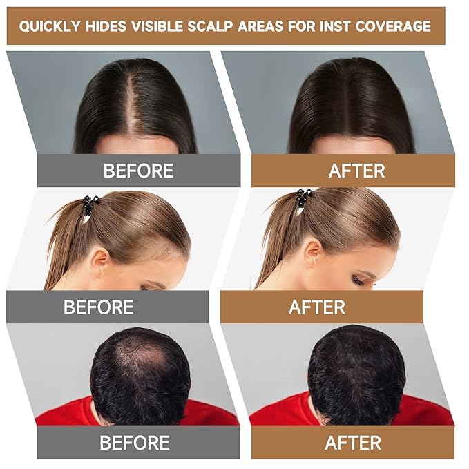 Root Touch Up Powder, Instantly Gray Hair Cover Up, Women Color Root Coverage Shadow Powder for Thinning Grey Hairline, Men Roots Concealer for Hair Loss Beard Line Eyebrow, White