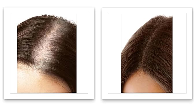 Caboki Root Touch Up Hair Volumizer: Fill in Hairline & Edges, Cover Thinning, Hair Loss, Bald Spots & Gray. TALC-Free, Healthful Men Women Light