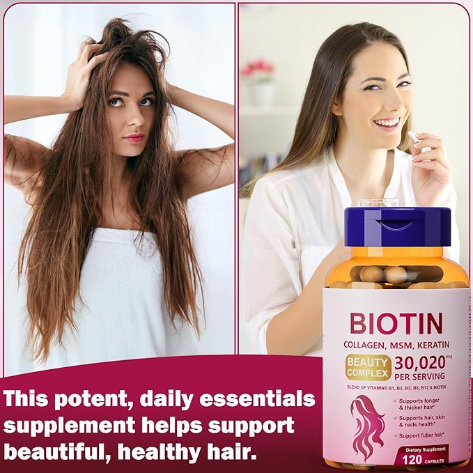 25-in-1 Biotin Supplement for Longer, Thicker & Healthier Hair, with Kertain, MSM, Zinc, Natural Herbal Extracts, Hair Growth Capsules Perfects for Women and Men, 120 Capsules