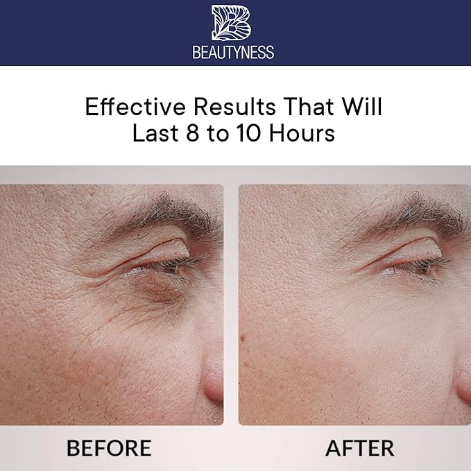 Instant Ageless Eye Cream – Anti Wrinkle Cream, Removes Under Eye Puffiness, Bags, Expression Lines, & Dark Circles. Powerfully Tighen & Lifts Sagging Skin. Disappears Before Your Eyes In Minutes.