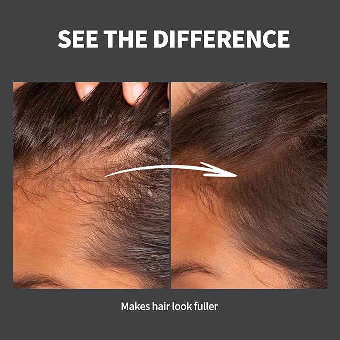 Hairline Powder 24H Stain-Proof, Root Touch Up Hair Color for Gray Coverage,Bald Spot Concealing Hair Shadow Powder for Women & Men,Natural-Looking (Blonde)