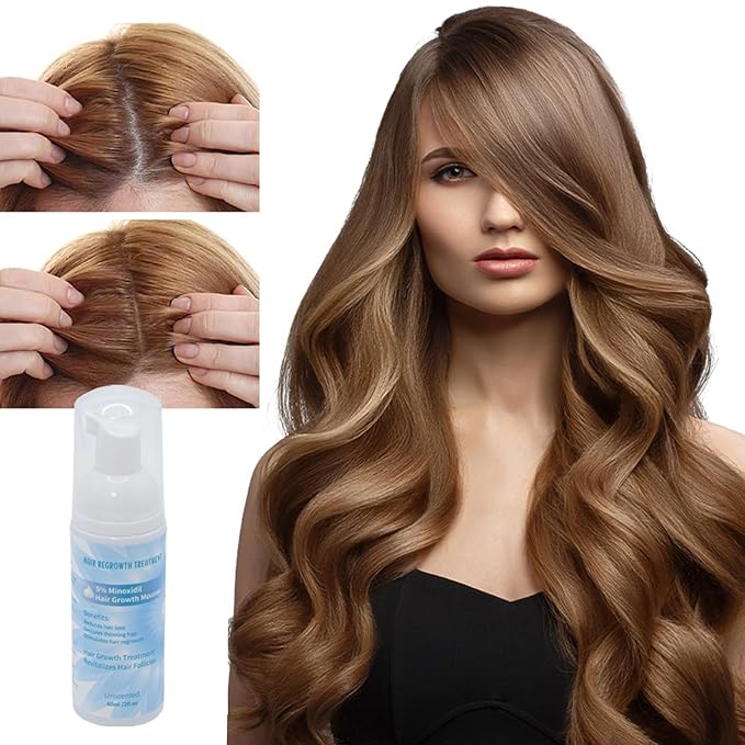 Minoxidil 5% Foam for Hair Growth, Topical Hair Loss Treatment for Men and Women, 3 Pack (2 oz Bottle) (1PC)