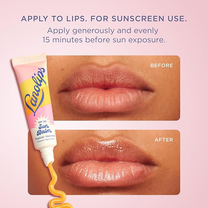 Lanolips Sun Balm Tropical SPF 30 Lip Balm - Hydrating Lanolin Lip Moisturizer with Pineapple Scent - Beach Essentials & Sun Care with Broad Spectrum UVA/UVB Protection - Untinted (0.44 oz)