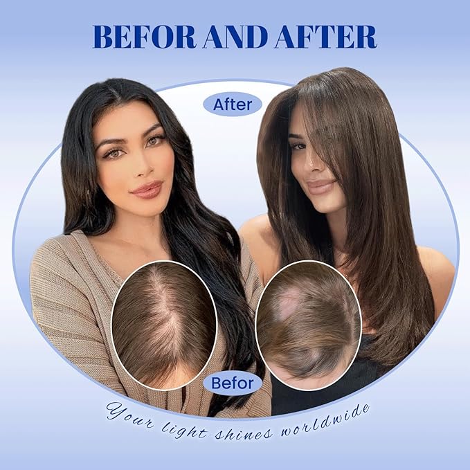 WORLDSTAR Human Hair Toppers for Women Real Human Hair No Bangs 6 * 7 Inch Base 12 Inch 55g #60 Platinum Blonde Hair Topper for Women with Thinning or Grey Roots (tp#60-12