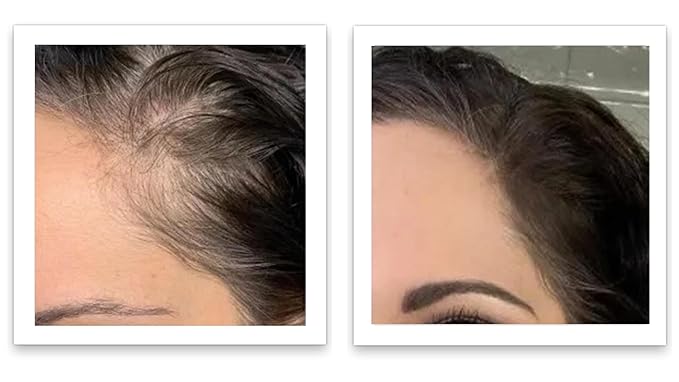 Caboki Hair Volumizer: Root Touch Up & Fill in Thinning Hairline, Cover Bald Spots & Gray Hair. TALC-Free, Healthful Powder for Men & Women. Golden Blonde