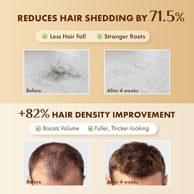 Hair Growth Serum Scalp Treatment: Scalp Serum with Rosemary, Multi-Peptide & Caffeine for Anti Hair Loss and Thinning - Thickening and Density for Women & Men