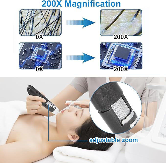 Skin Hair Scalp Detector Skin Analyser 200X Magnification 2MP USB High Definition Digital Microscope for Hair Skin Care
