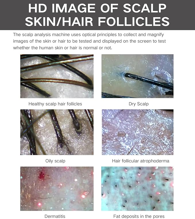 5 in 1 Skin Scalp Detector, Skin Diagnosis Hair Analyzer, Scalp Hair Follicle Detector with 4 Spectral Detection, 200 Times Magnification, for Home, Beauty Salon Spa