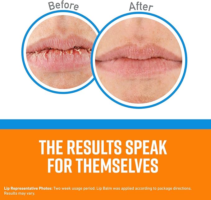 O'Keeffe's Cooling Relief Lip Repair Lip Balm for Dry, Cracked Lips, Stick, (Pack of 10)