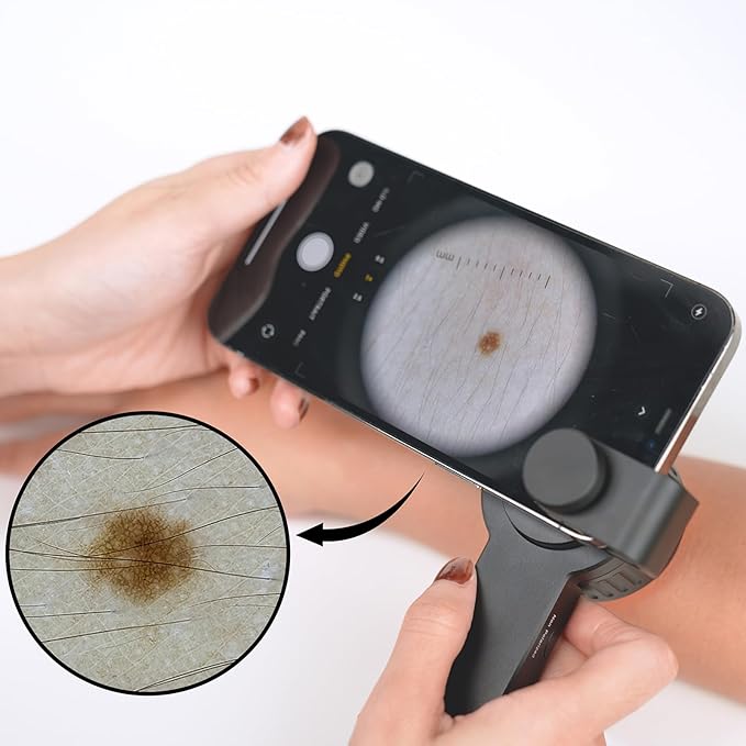 IBOOLO DE-3100 PRO Polarized No-Polarized and 365nm UV Light Dermatoscope, Handheld Portable Professional dermatoscopy