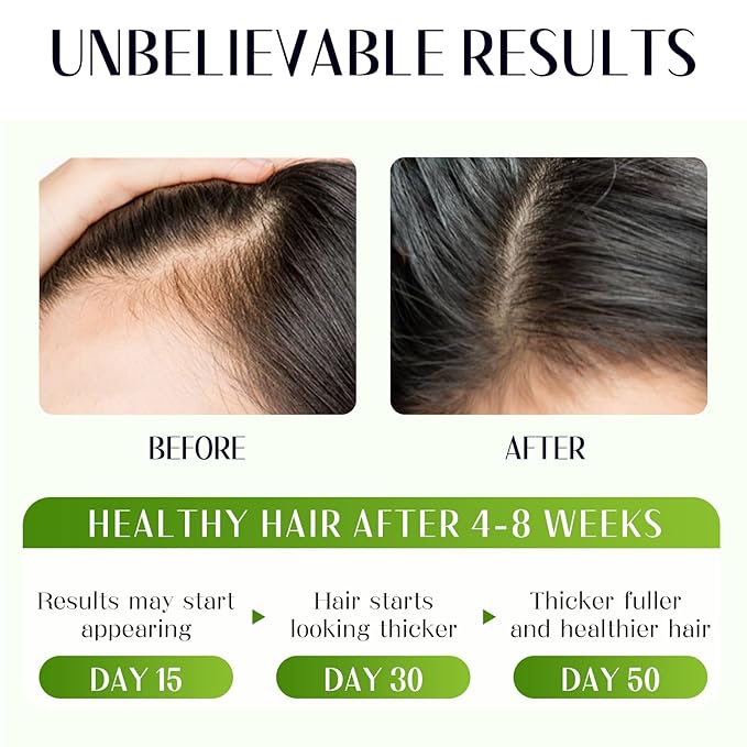 Raw Batana Oil for Hair Growth 4-in-1 Batana Oil with Rosemary, Castor Oils and Biotin for Reduce Hair Loss, Scalp Care, Repair Damaged Hair