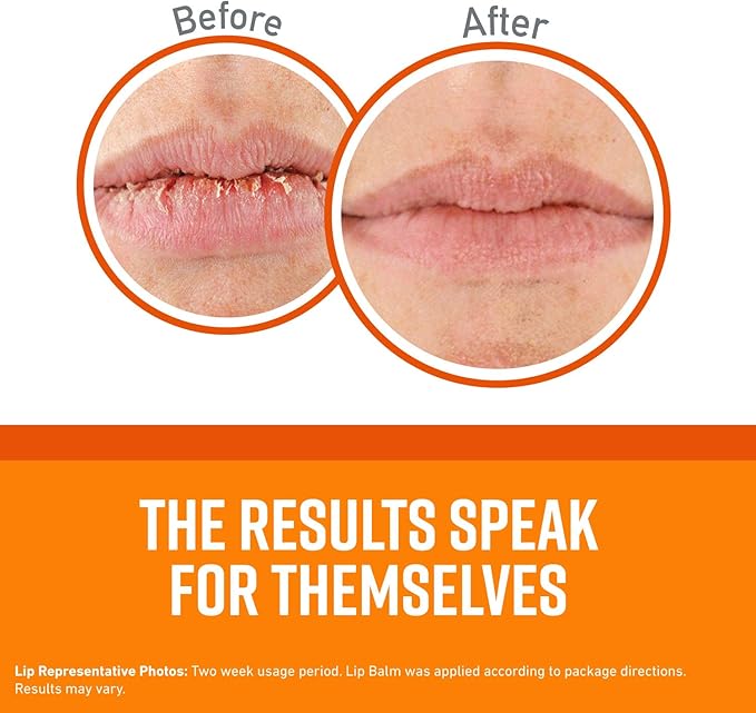 O'Keeffe's Lip Repair Lip Balm for Dry, Cracked Lips, Stick, (Pack of 4: 3 Cooling + 1 Unscented)