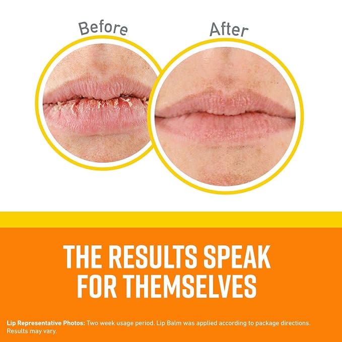 O'Keeffe's Lip Repair SPF 35 Lip Balm, (Pack of 2)