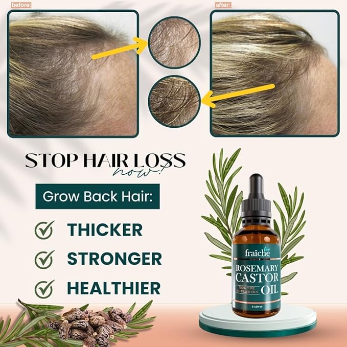 Live Fraiche Rosemary Oil for Hair Growth (2oz) with Cold Pressed Castor Oil Natural Hair Growth Oil - Rosemary and Growth for Hair Castor Oil -Strengthening Hair Oil for Damaged Hair and Hair Loss
