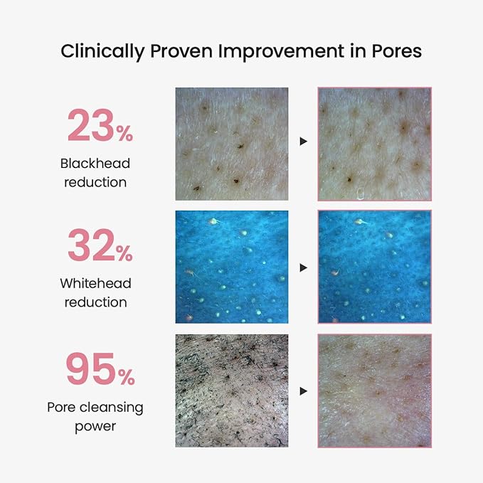 BIODANCE Collagen Cleansing Oil, Facial Oil Cleanser, Gentle Makeup Remover without Clogging Pores, Removes Bleackhed and Whitehead for Sensitive Skin, Oily Skin, Korean Skincareㅣ6.76 fl. oz. (200 ml)