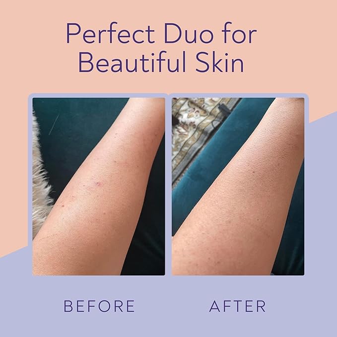 KP Bump Eraser Body Scrub & Keratosis Pilaris Lotion Bundle Set – Strawberry Legs Treatment for Women - Exfoliates & Deeply Hydrates for Smoother Healthy-Looking Skin