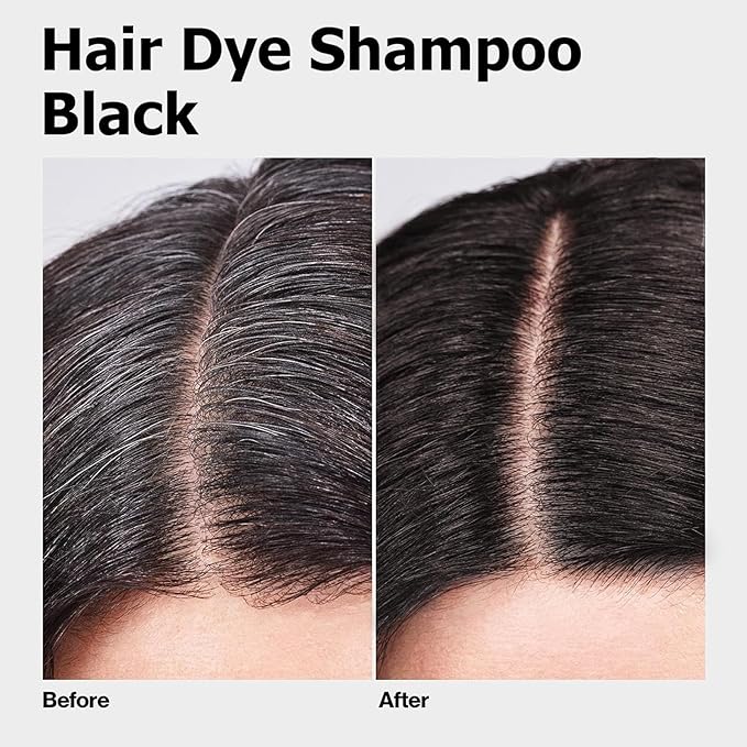 Black Long-Lasting & Natural Hair Color Shampoo - 3 in 1 for Gray Coverage, Instant Effect in Minutes for Men & Women, 16.9 Fl Oz