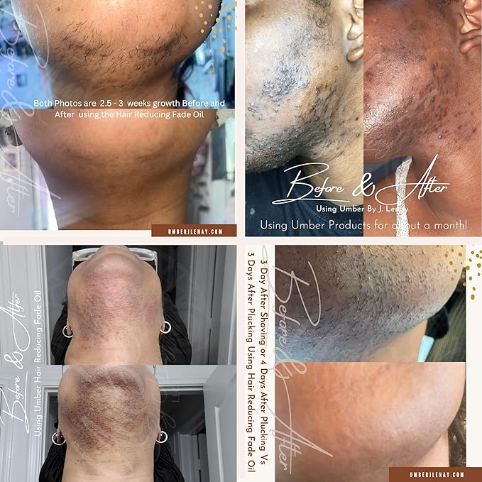 Hair Reducing Fade Oil - Sentive Strength (For sentive skin) Hair Growth Minimizer, Slow Down Facial Hair Growth for Women & Men, Hair Inhibitor Serum, Moisturizing & Soothing, 15ml