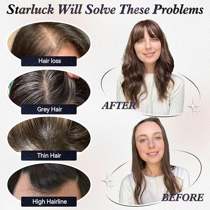 starluck Hair Toppers for Women Real Human Hair With Bangs, 100% Remy HumanHair Toppers for Women Hand-woven with Thinning,Cover Gray Roots,Adds Volume, Brown
