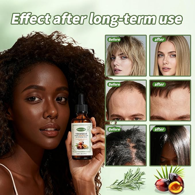 2 Pack Organic Batana Rosemary Oil for Hair Growth & Anti-Hair Loss, 2PCS 1 fl oz Natural DHT Blocker Scalp Treatment for Thinning Hair, Nourishing Dry Scalp & Strengthening Follicles