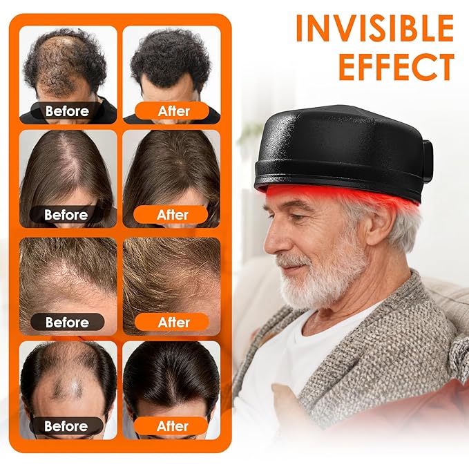 Hair Growth Device LS-D630 - Promote Hair Growth in Males and Females with Androgenetic Alopecia