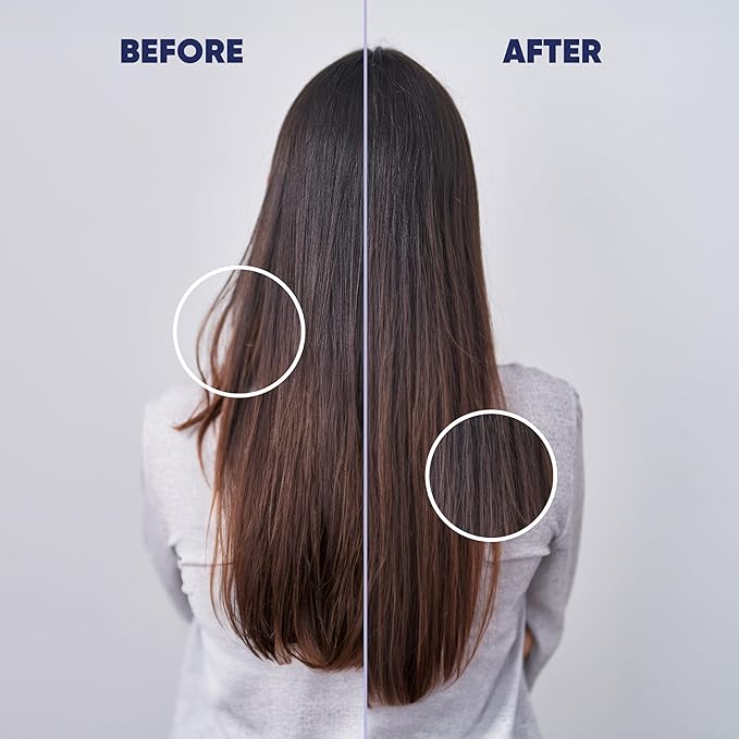 MOERIE Ultimate Hair Growth Serum for Natural Hair Regrowth & Thickening - Anti Thinning & Hair Loss Treatment for Women - Rapid Hair Growth Products - Scalp Oil Alternative - 1.69 fl oz, 2 pack