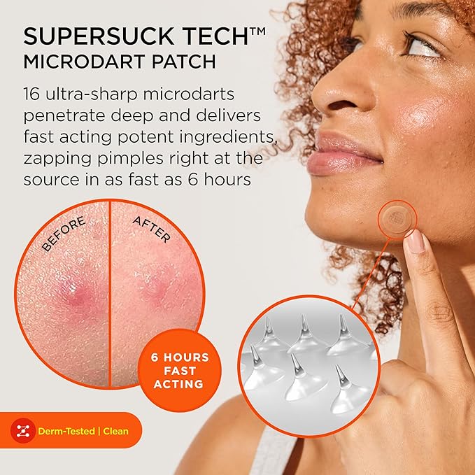 ZitSticka Killa Pimple Patches for Face - World's Most Potent Pimple Patch with Fast-Acting Microdarts - Starts Working within 26 Hours for Deep, Early-Stage Zits - Mini 24 Count