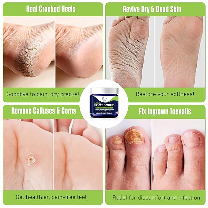 Exfoliating Foot Scrub with Pumice Stone powder - Gentle Moisturizing Foot Scrub for Dry Skin - Cracked Heel Repair for Smooth, Soft Feet - Pedicure Foot Spa 1 Pack
