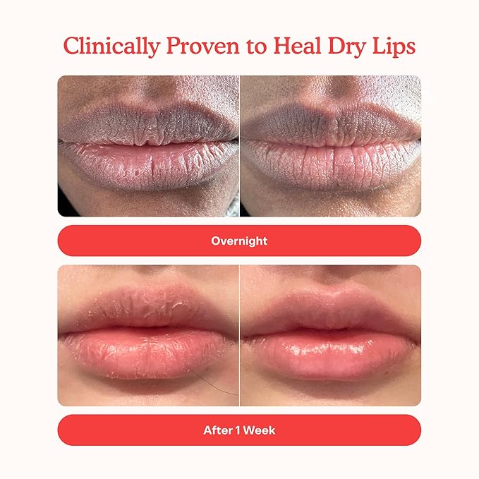 Tower 28 LipSoftie Hydrating Tinted Lip Treatment Balm, Moisturizing Lip Mask for Chapped Lips - Ube Vanilla Flavor, Sheer Burgundy Gloss