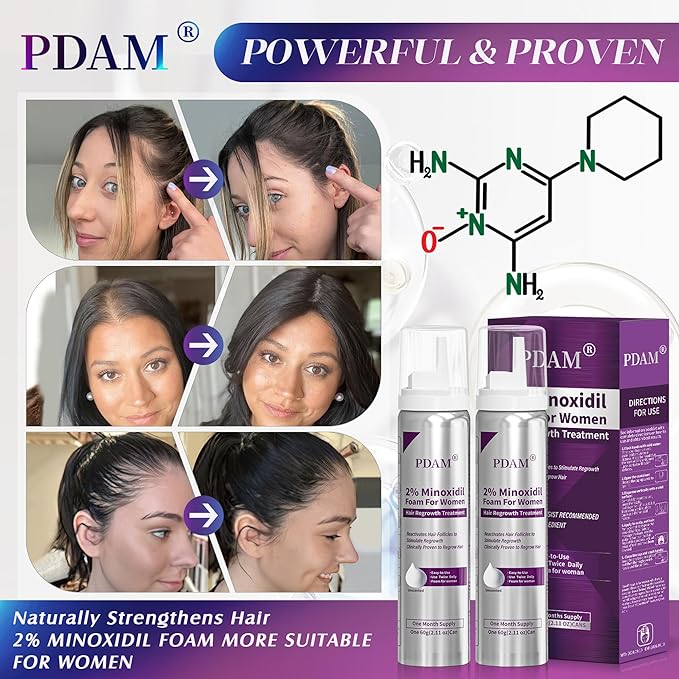 Minoxidil for Women Foam Hair Growth - Minoxidil Hair Regrowth Treatment for Women, Topical Solution Hair Loss Treatments, Thicker and Fuller Hair, 2-Month Supply, 2 x 2.11 oz