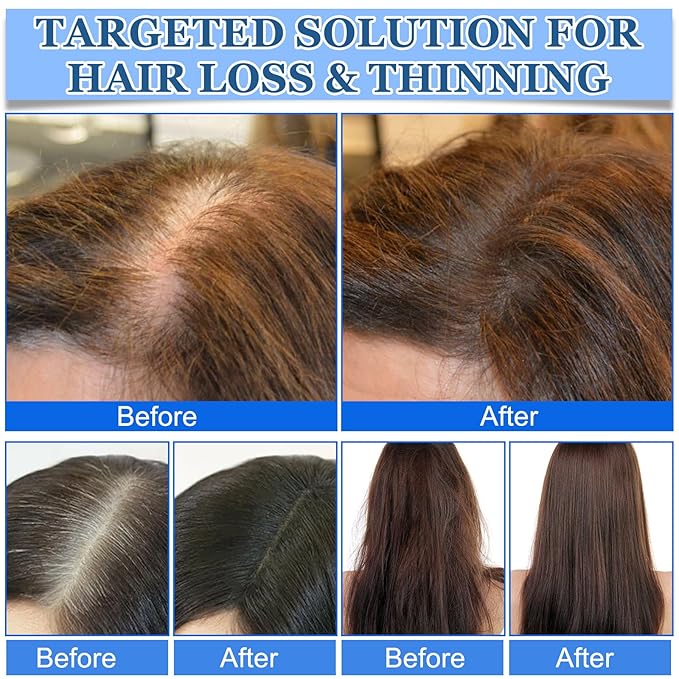 Advanced Hair Growth Serum Roll-On,Hair Growth Roll-On Serum for Men & Women for Hair Loss & Thinning,Nourishes Scalp & Roots,Non-Greasy,Lightweight For All Hair Types(10ml,3pcs)