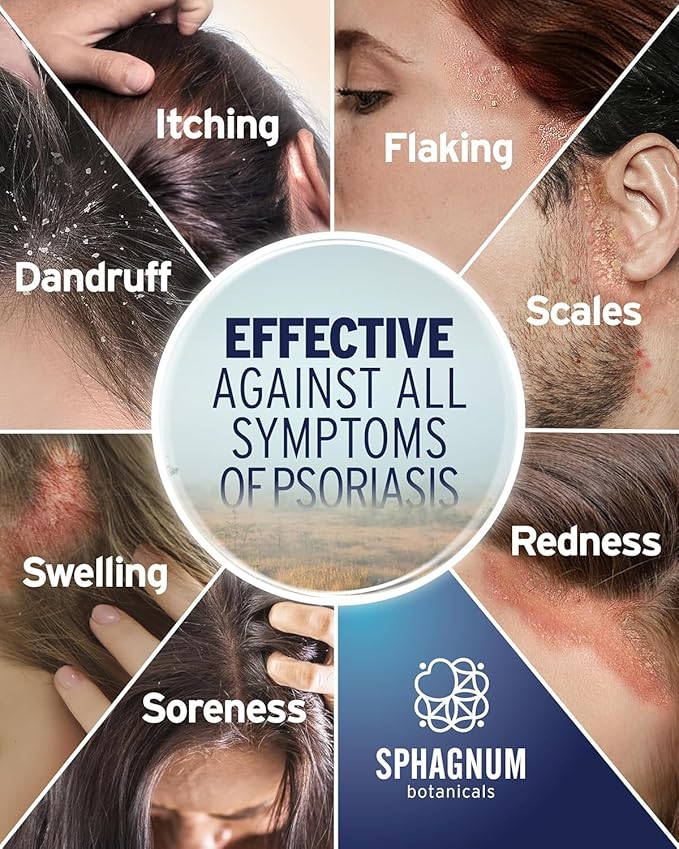 Sphagnum Botanicals Psoriasis Shampoo with Salicylic Acid – Natural Scalp Treatment for Dry, Itchy, Flaky Scalp with Menthol & Peat Mud – Sulfate-Free, Gentle Formula – 8.45 fl oz
