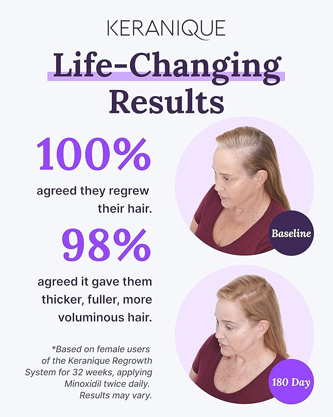 Keranique Hair Regrowth Treatment for Women - 2% Minoxidil for Women Hair Growth & Thickening - Topical Solution Scalp Treatment for Hair Loss & Thinning w/Precision Spray Applicator - 4 Fl Oz
