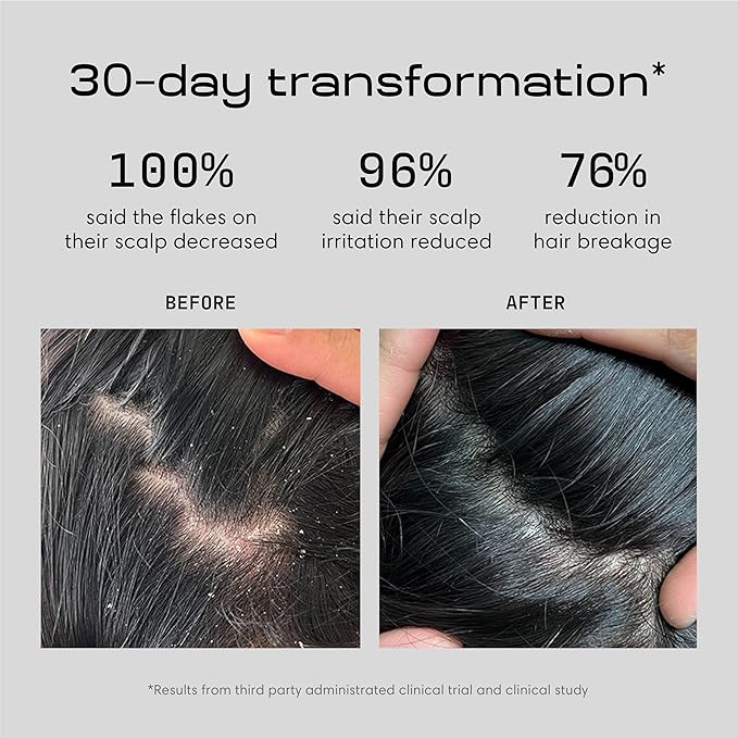 Jupiter Balancing Anti Dandruff Shampoo Duo, for Women & Men, Physician-Formulated for Flaky, Itchy, Oily, Dry Scalp, & Paraben-Free, Anti-Dandruff Shampoo with Zinc, 2 pack, 14 fl oz ea