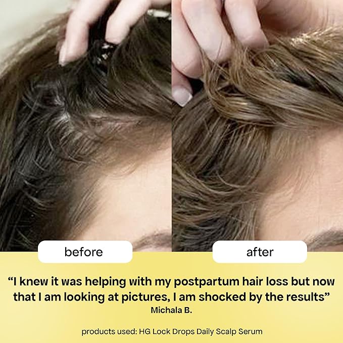BondiBoost HG Lock Drops Daily Hair Serum (60ML) – Non-Greasy, Reduces Hair Thinning, Stimulates Scalp, Supports Thicker Fuller Hair – Vegan, Color-Safe, Lightweight for All Hair Types & Textures