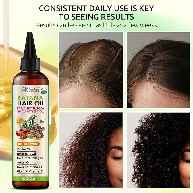 Hair Growth Oil with 100% Pure Batana, Castor, Rosemary & Pumpkin Seed Oils – Infused with Biotin, Keratin & Vitamin E – Strengthening & Thickening Treatment for Healthy Hair – 4 FL OZ