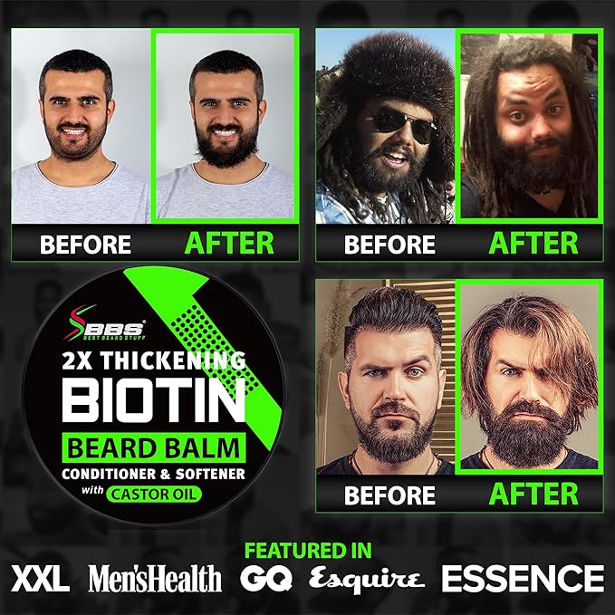 Biotin Beard Balm + XXL Beard Growth Serum + 620,000mcg Beard Growth Vitamins – Beard Growth Kit for Men with Mustache Wax, Collagen, MSM & Castor Oil – Fills Patches, Thickens & Styles