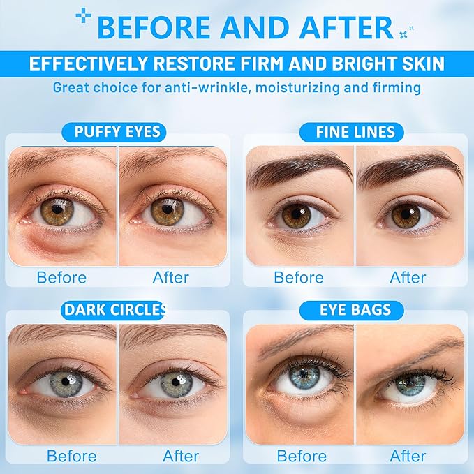 Under Eye Patches for Puffy Eyes: 30 Pairs Retinol Collagen Eye Gels Pads - Reduce Wrinkles, Puffy Eyes, Eye Bags - Skin Treatment Mask with Retinol Collagen - Anti Aging & Face Moisturizer