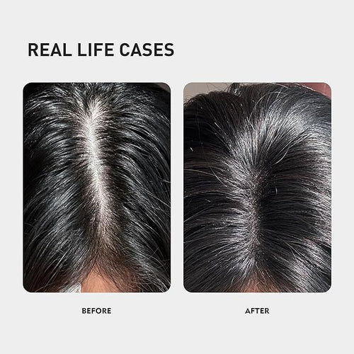 0.9% KX-826 KINTOR Hair Growth Spray,Strengthen Hair Nourish Hair follicles,Hair Care Products for Sparse Hair and Oily Hair Men&Women,300ml,Pro