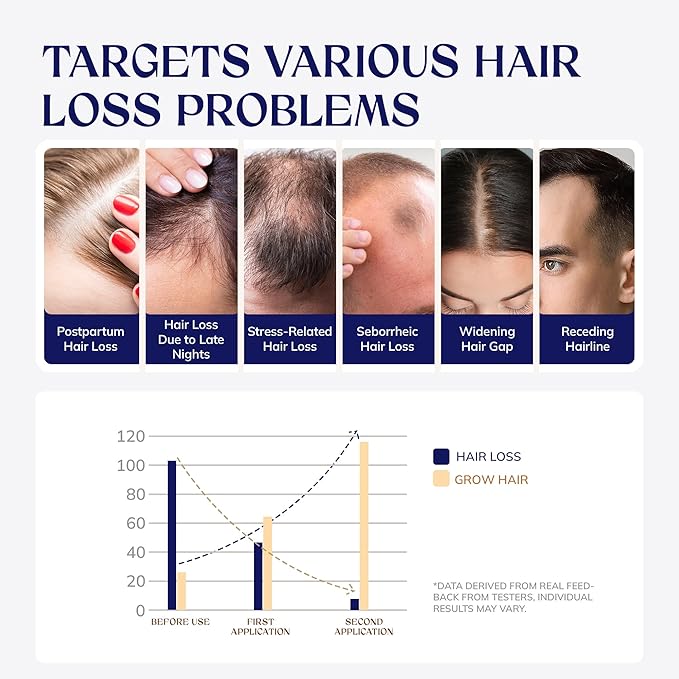 Hair Growth Spray, Rice Water & Biotin & Caffeine, Hair Growth Serum for Men & Women, Hair Oils for Hair Growth -Longer, Fuller Hair, Enriched with Seven Herbal Extracts 2.03 Fl Oz (Pack of 1)