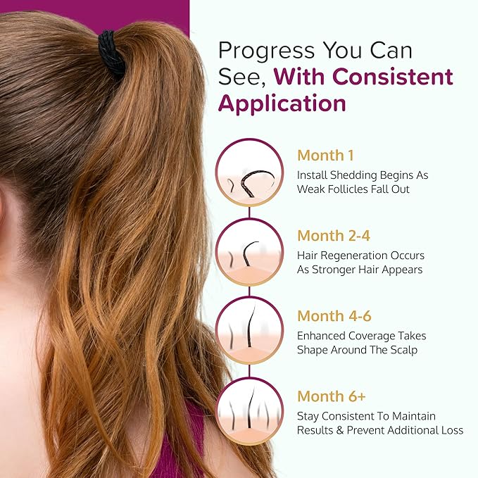 Minoxidil for Women 5% Foam - Helps Restore Top of Scalp Hair Loss and Support Hair Growth for Women, Regrowth with Unscented Topical Treatment for Thinning Hair (5% Foam 8-Month Supply)