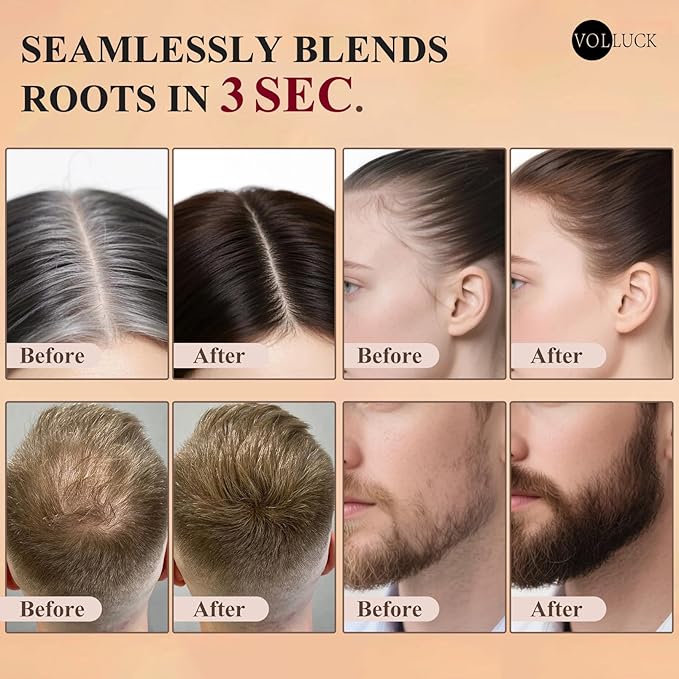 VOLLUCK Hairline Powder Instantly, Root Touch up Powder Hair Color Upgraded, Grey Root Cover up Conceals Hair Loss, Hairline Shadow for Women & Men for Thinning Hair Natural, Sweatproof (Blonde)