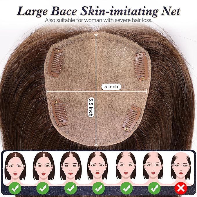 starluck Hair Toppers for Women with Bangs, 5"*5.5"Large Coverage Ombre Ash Blonde 100% Real Human Hair Toppers for Women with ThinningHair,Cover Gray HairRoots