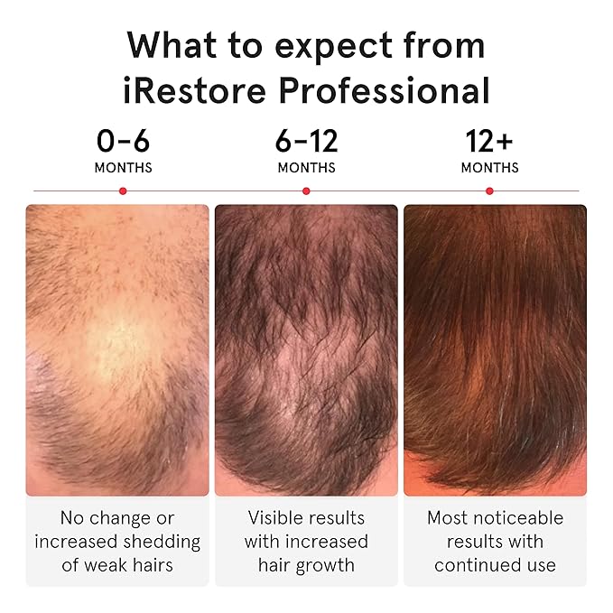 iRestore Professional + Rechargeable Battery Pack - Laser Red Light Therapy for Hair Growth - FDA Cleared Hair Loss, Thinning Treatment for Men & Women - Hair Regrowth Cap - 282 Lasers & LEDs