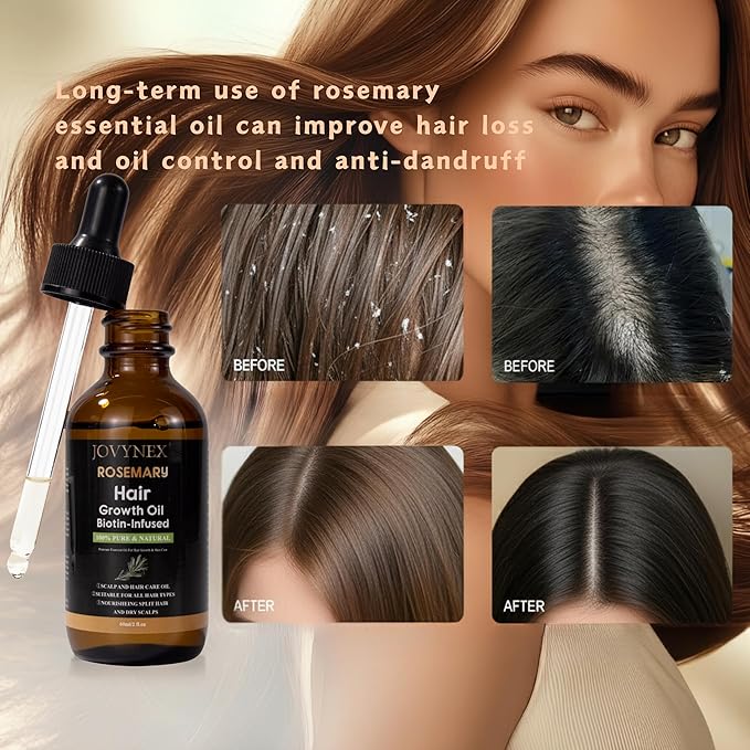 Rosemary Oil for Hair Growth with Biotin - Natural Hair Growth Serum for Thicker Hair, Anti-Hair Loss & Thinning Hair Treatment, Organic Scalp Stimulating Oil for Men & Women (2 fl.oz)